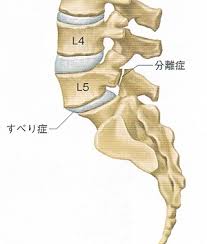 分離