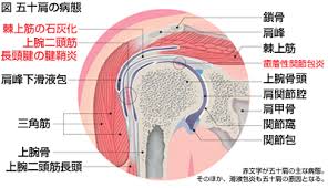 五十肩